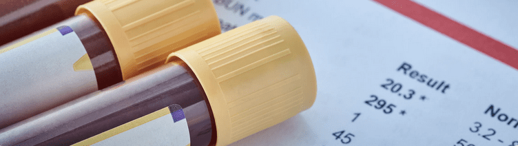 Blood Tests