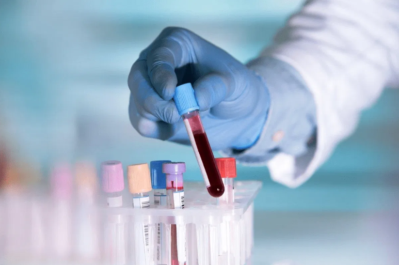 What “Normal Range” Actually Means on a Blood Report